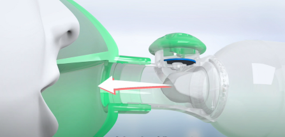 Masque OrHal illustration